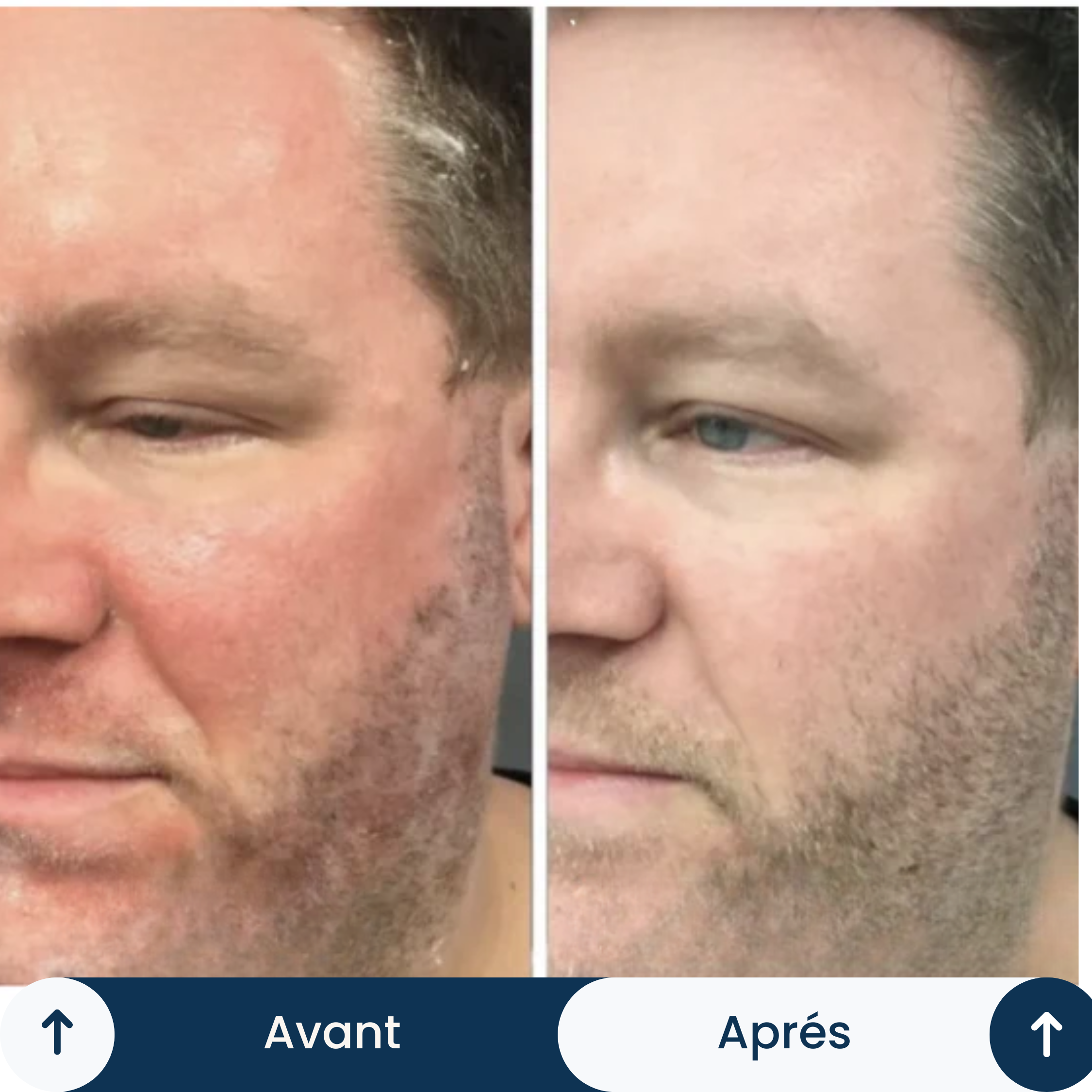 Crème DermaVe