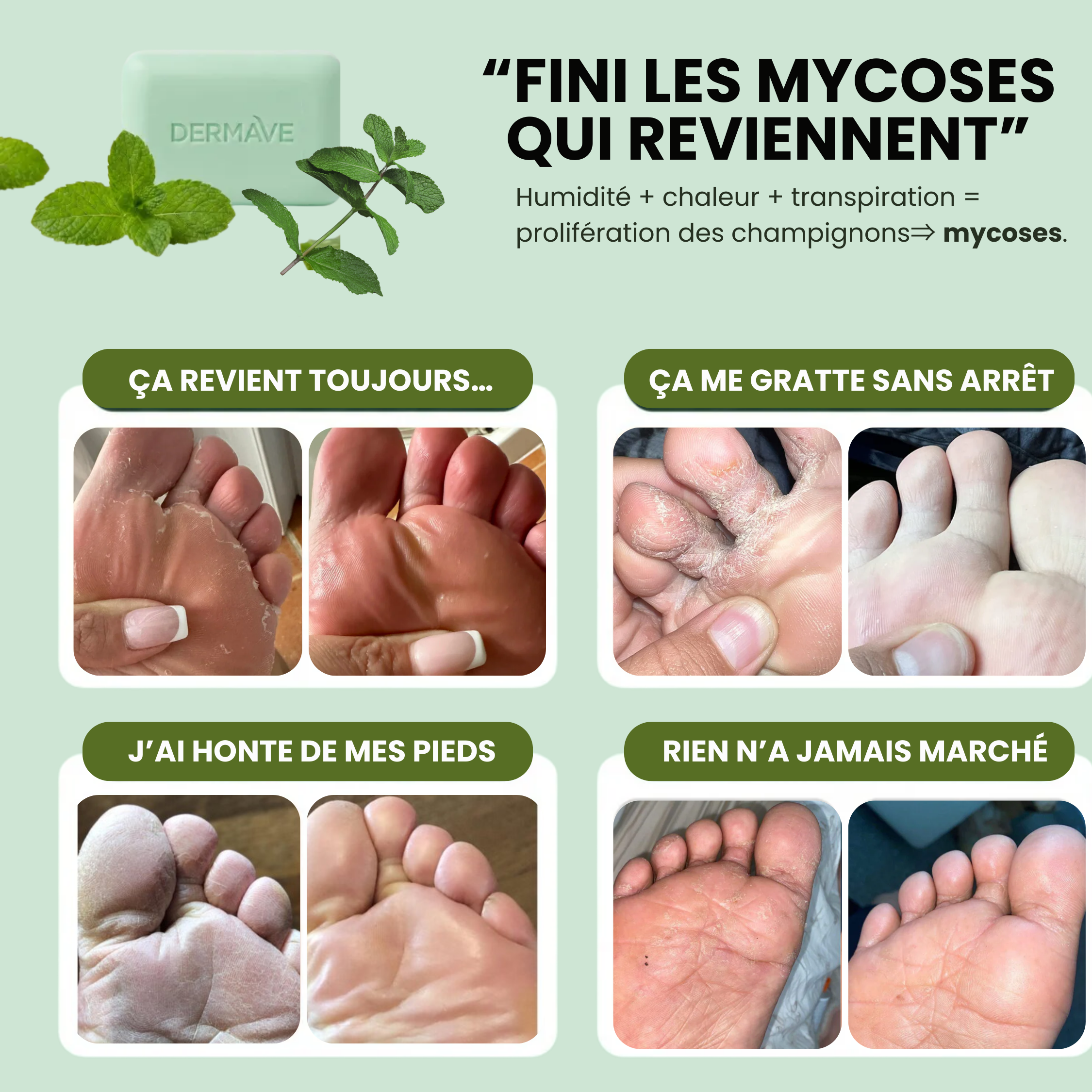 Savon DermaVe® Anti-Mycoses