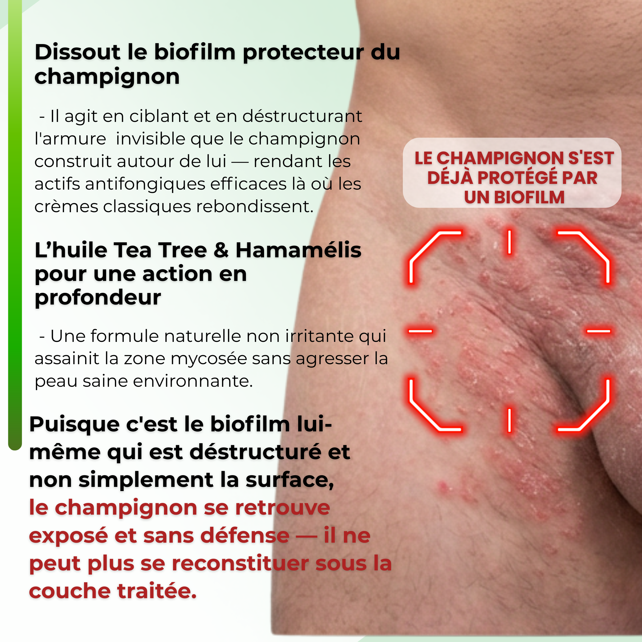 DermaVe® Savon Anti-Mycoses