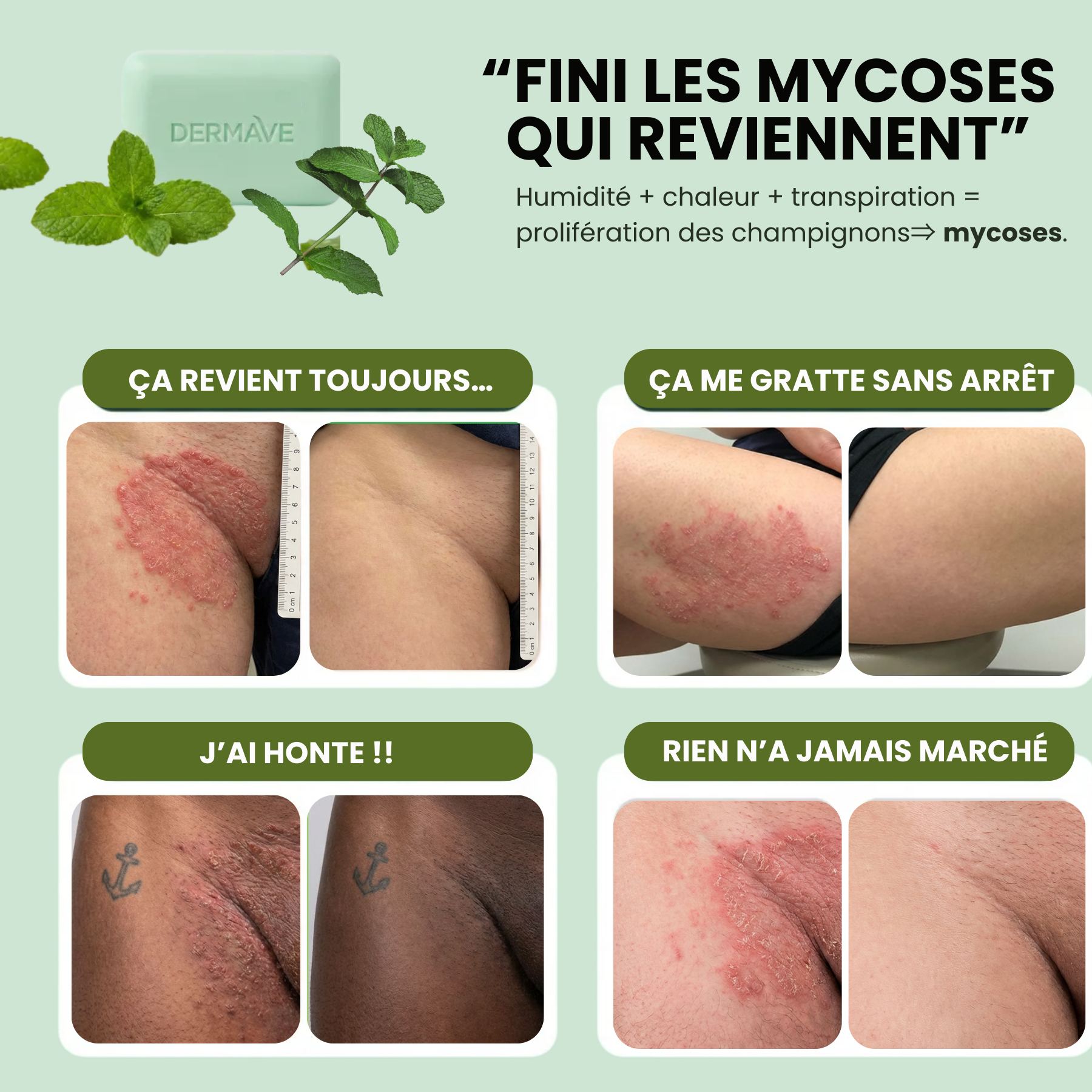 DermaVe® Savon Anti-Mycoses